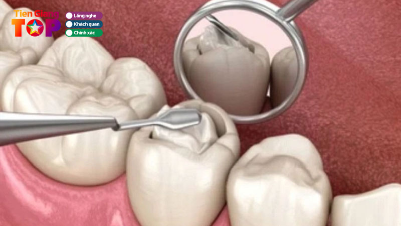 Top-10-dia-chi-tram-rang-tai-tien-giang-uy-tin-nen-tham-khao-tiengiangtoplist